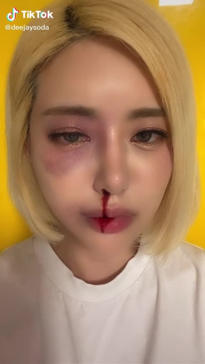 아파……..😭😭😭😭😭