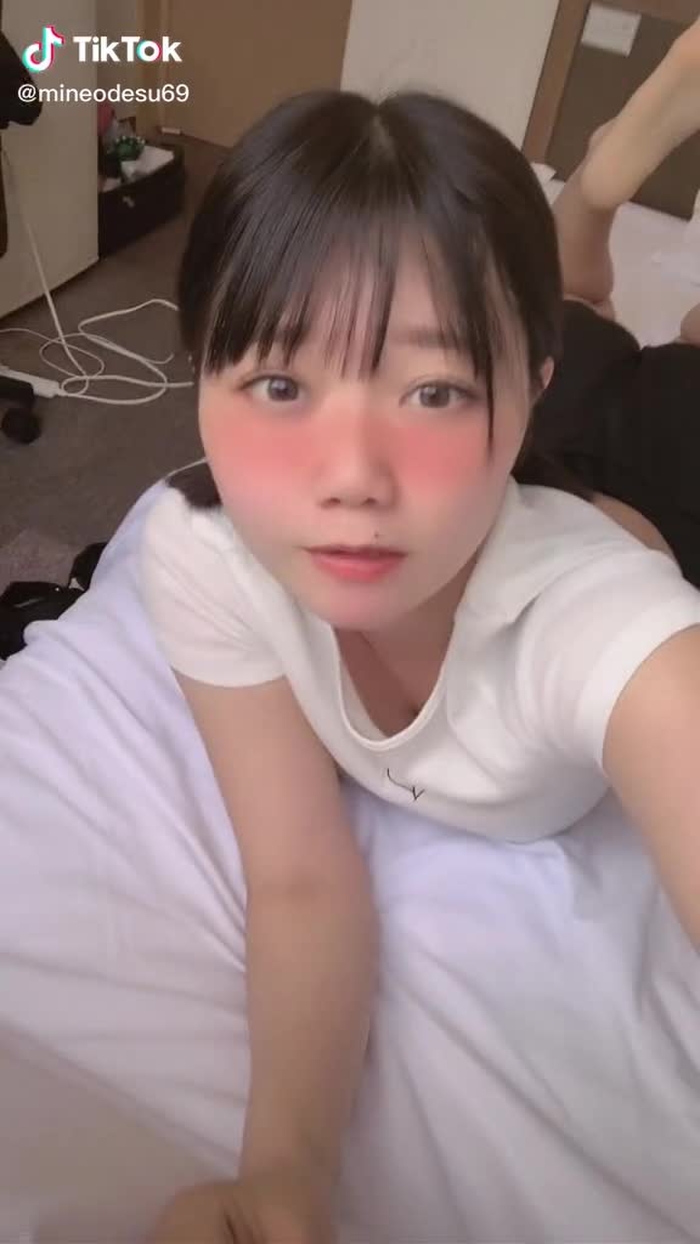 片目だけより目、できました？🥲🥲🥲しんぽってなんなんや#日焼けしちゃった