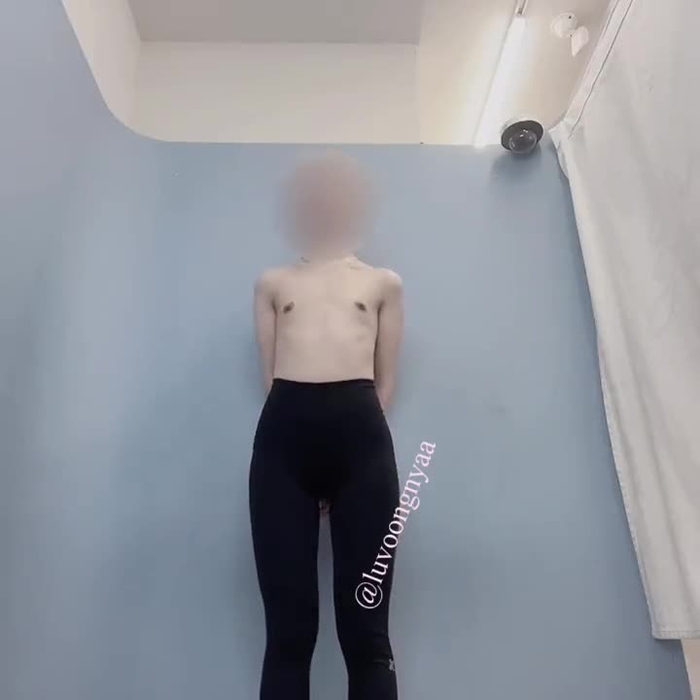 exposure r03153685 30